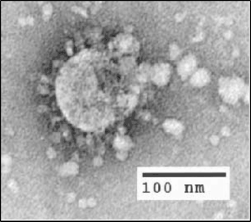 SARS outbreak spreads worldwide