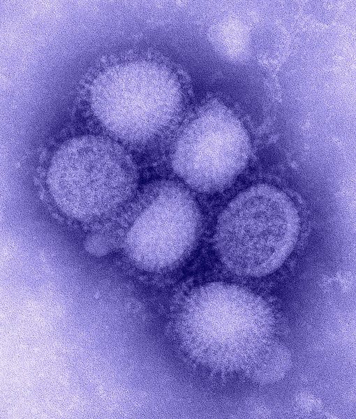 Swine flu spreads across the UK