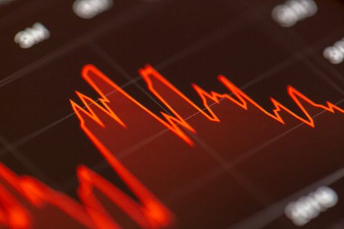 Silicon Valley Bank collapses in largest bank failure since 2008
